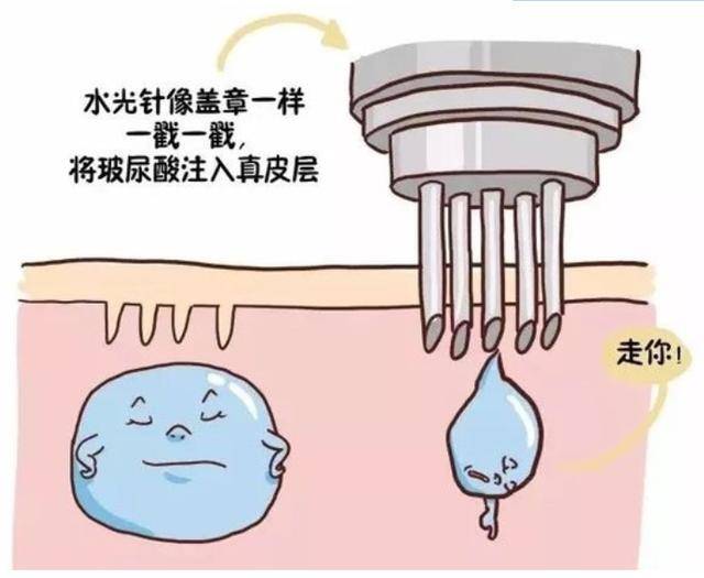 做中胚層療法沒有效果注意這幾點