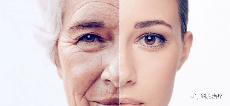 干细胞技术:使人类衰老细胞恢复年轻状态