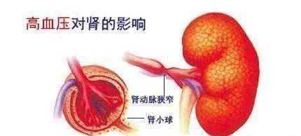 肾动脉分段图片