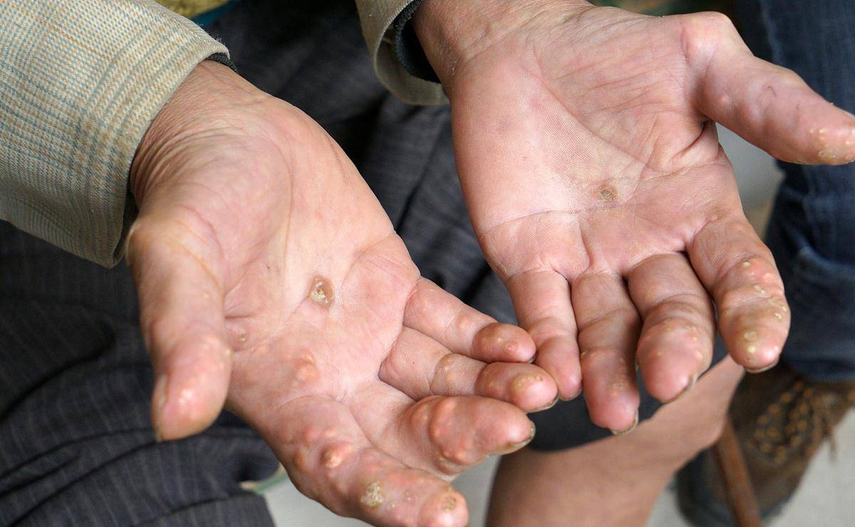 原创晚上睡觉时,身体发出三种暗号,或是在提醒你:尿酸早已超标