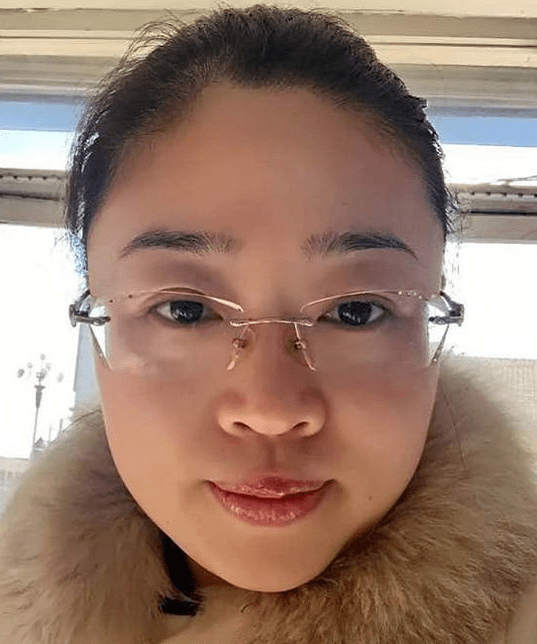 额头窄,并且有凤毛的干扰,这种现象在面相中称为"凤毛额上角",主要