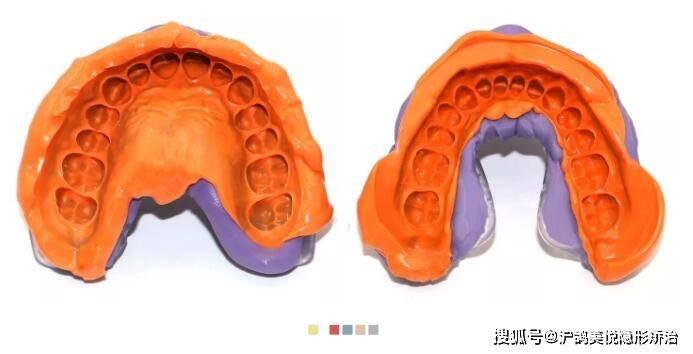 沪鸽美悦隐形矫正 | 硅橡胶取模常见问题和操作流程