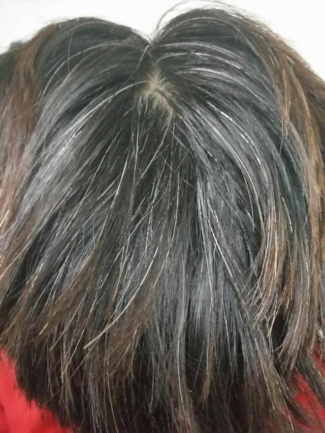 许是少年愁白了头?别担心,巧用3个方法,亦或能白转黑