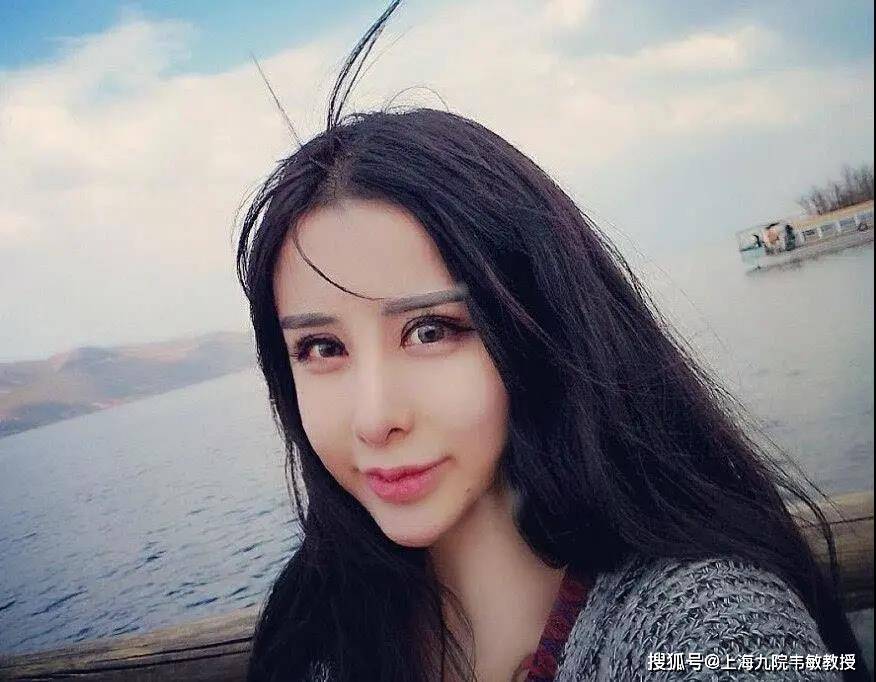 韦敏教授经验分享丨什么样的脸型更抗老