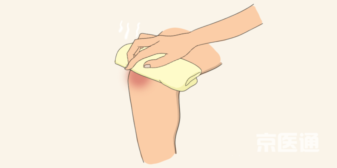 京医通 | 崴脚,落枕,痛风……常见的十种情况,该热敷还是冷敷?