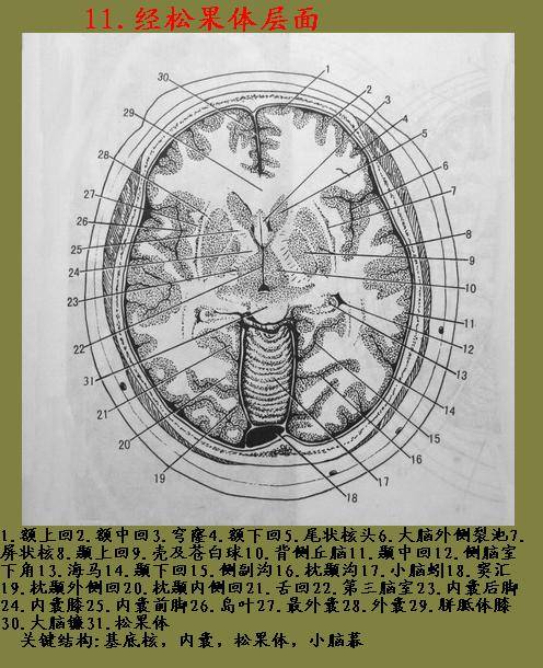 頭部橫斷層解剖圖譜線條圖