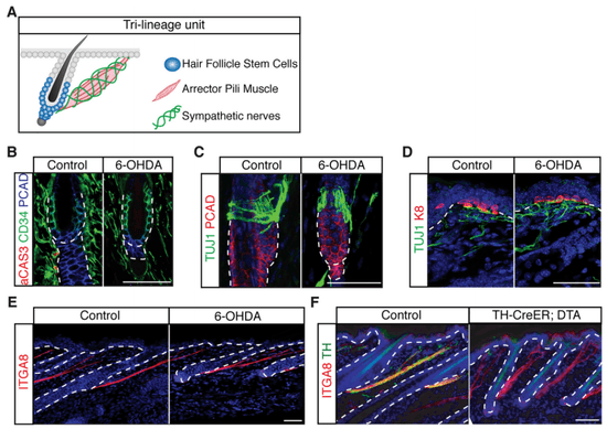 立毛肌鸡皮疙瘩(毛孔耸立鸡皮疙瘩)