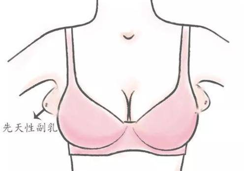 在胎儿时期,自腋窝到腹股沟线上有6～8对乳腺始基,正常情况下,当胚胎