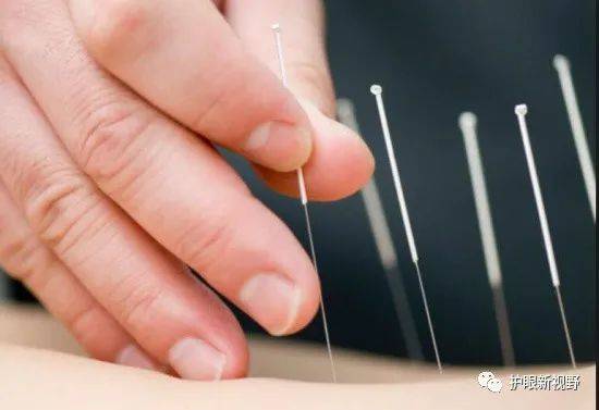 视神经萎缩不再是眼科不治之症可以试试针刺治疗