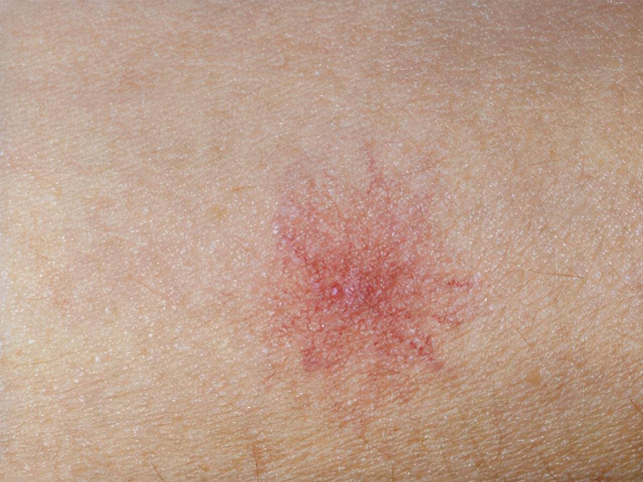 38岁男子不碰烟酒,却因肝癌离世!医生怒斥:妻子是罪魁祸首