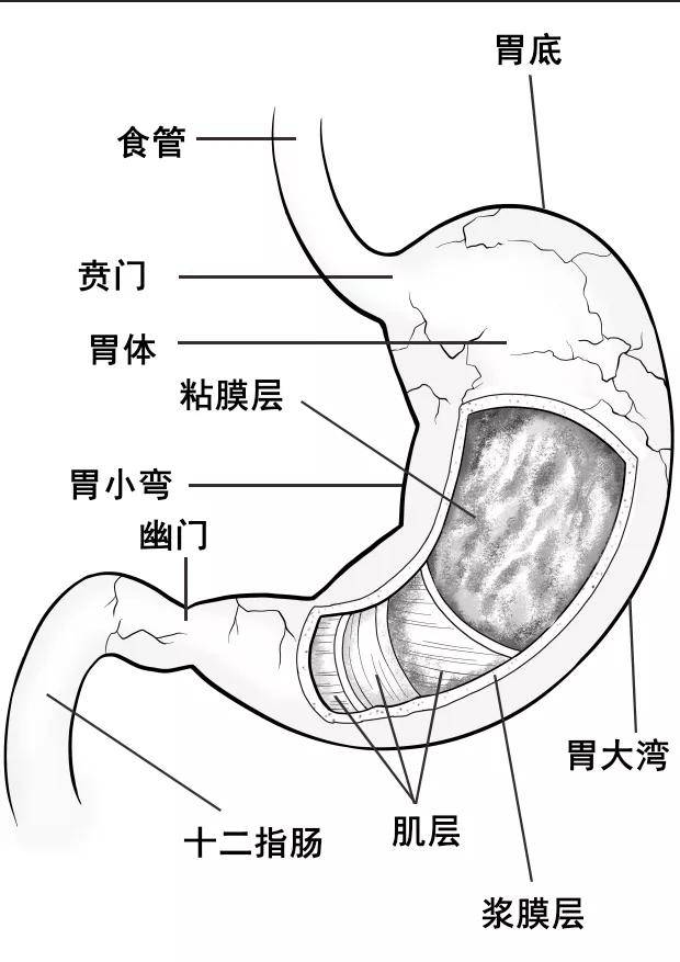 胆汁反流性胃炎危害大