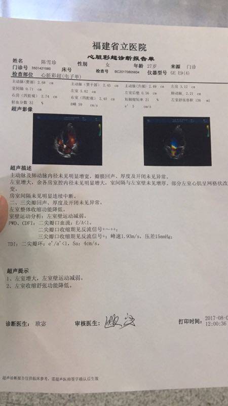 石家庄长兴医院中医治疗围产期心肌病患者心脏缩小实际病例