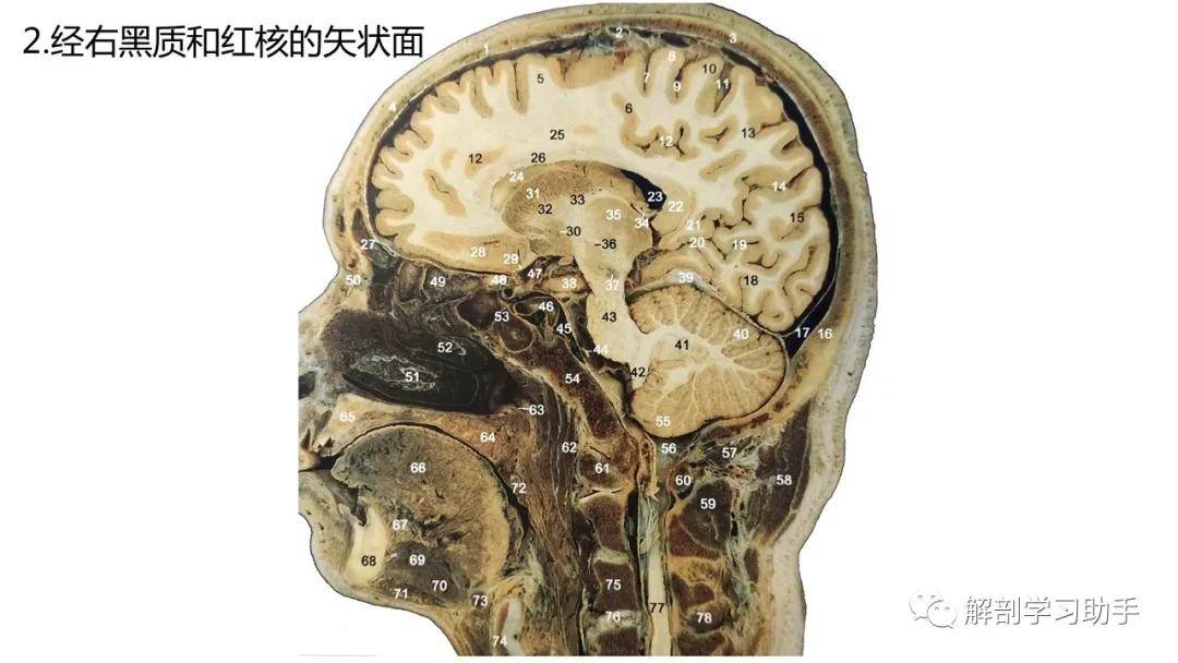 头颈部正中矢状断面图片