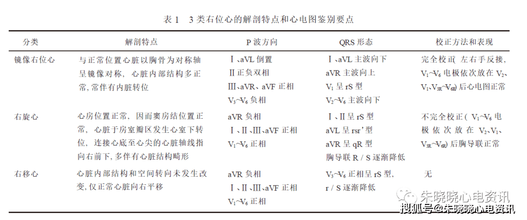 右位心心電圖3 例分析_診斷