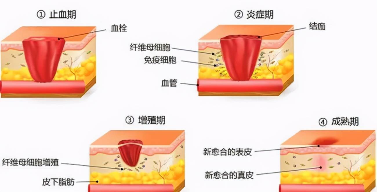 别人止血靠血小板,你靠组织液?_手机搜狐网
