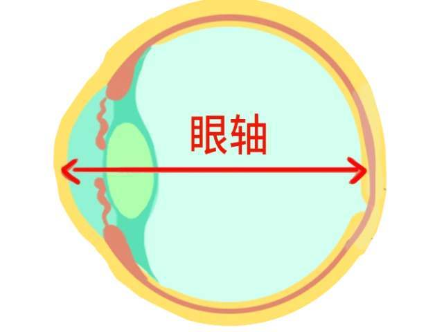 近视防控:眼轴增长1mm就代表近视增加300度吗?