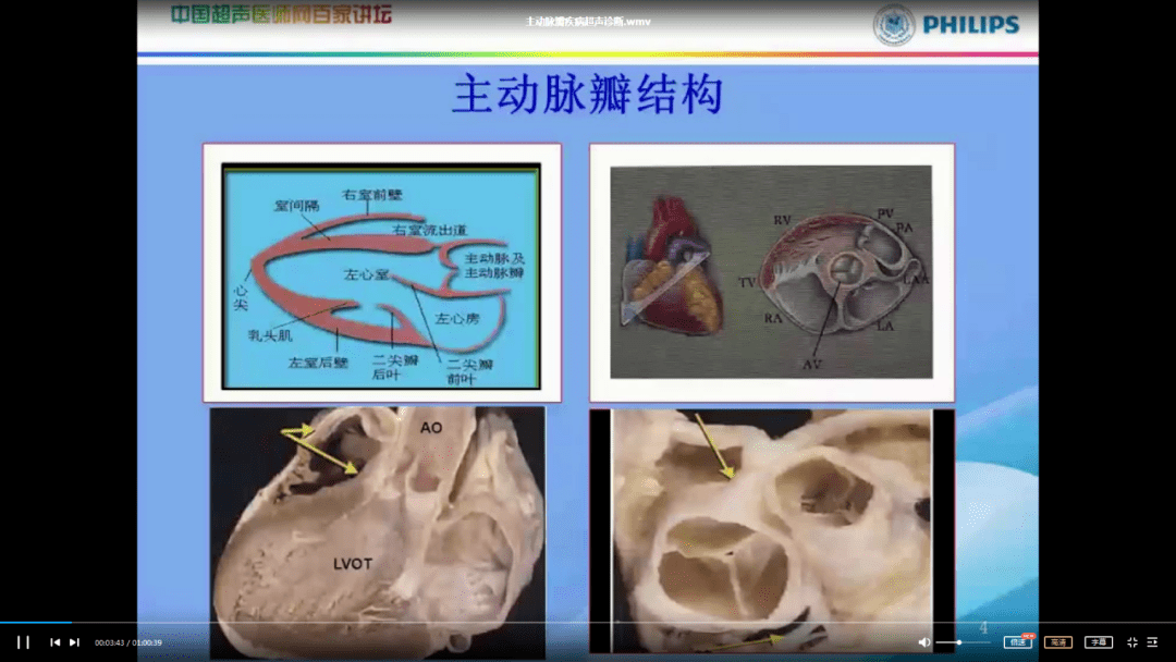 圖測量與計算 / 二尖瓣疾病的診斷 / 動脈粥樣硬化結構和彈性研究進展