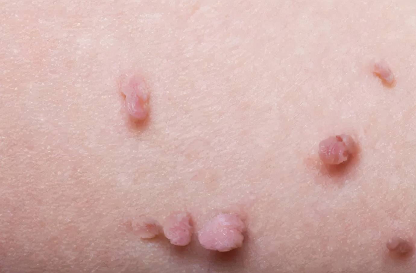 再贵的化妆品也阻止不了你变老除非你解决这个问题