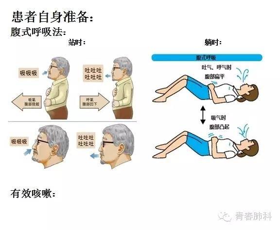 呼吸功能训练是肺癌术后康复治疗及护理的重要任务,其训练的目的是有