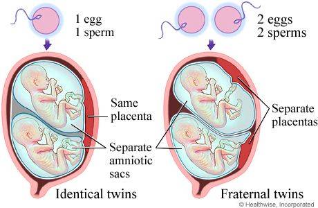 单卵双胎图片
