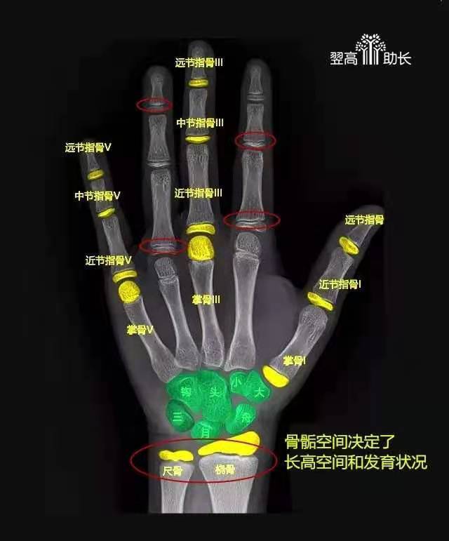 9岁娃12岁骨龄,身高丢了10厘米!孩子长高,关键是看