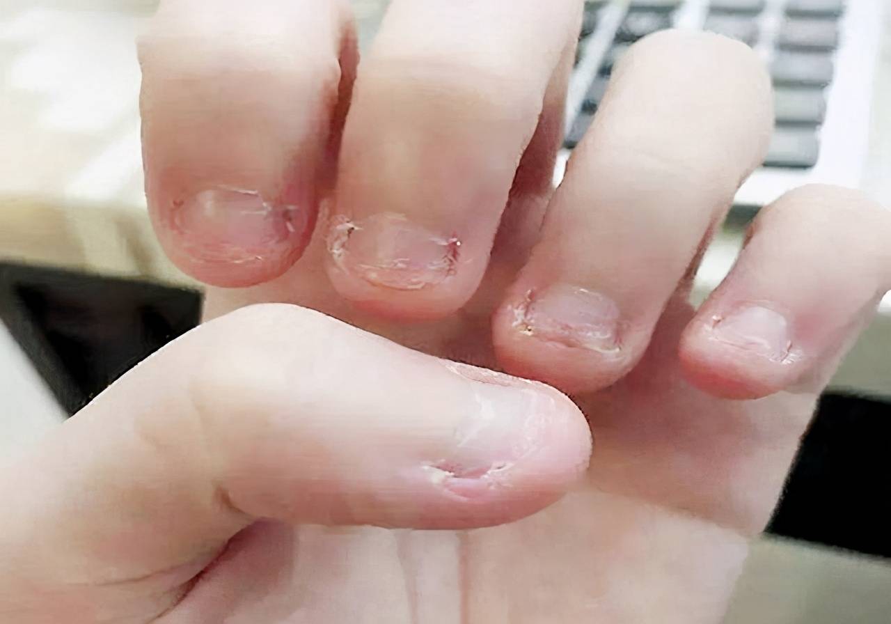 原创3岁以上的孩子还爱啃手指别再不当回事预示心理出现了问题