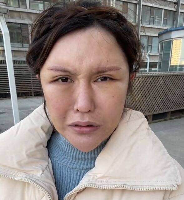 网红美娜分享近百次整容经历!花了这么多钱,还是这熊样_手机搜狐网
