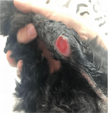 之后坚持涂抹葆喻凝胶,经过一周的时间,伤口已经基本愈合,从开始使用