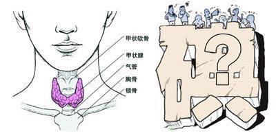 安徽中医药附院告诉您:为何体检查出甲状腺结节?