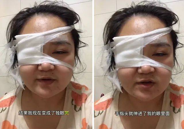 妈妈被宝宝戳成"独眼"后,网友心疼宝妈到想哭,我却更心疼宝宝_手机