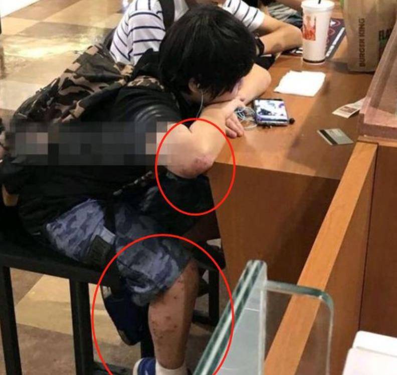 原创他2岁出道为父母挣钱花,今身材走样无戏拍,得皮肤病也不给医治!