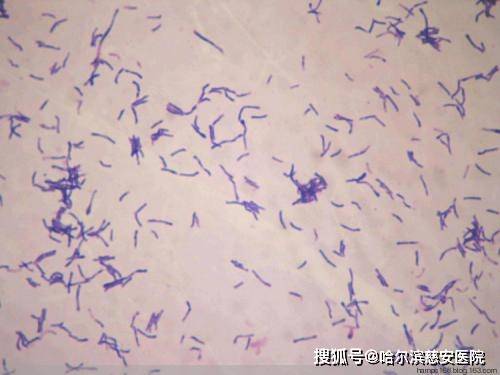 放线菌显微镜图图片