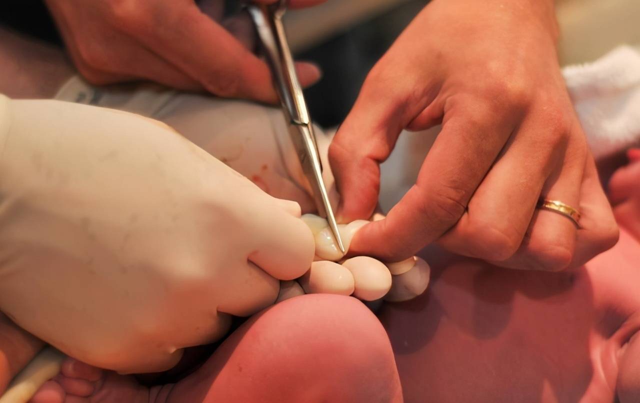 宝宝出生后为何剪脐带时他会哇哇大哭很疼吗医生说了大实话