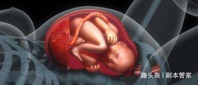 胎儿入盆真人图片