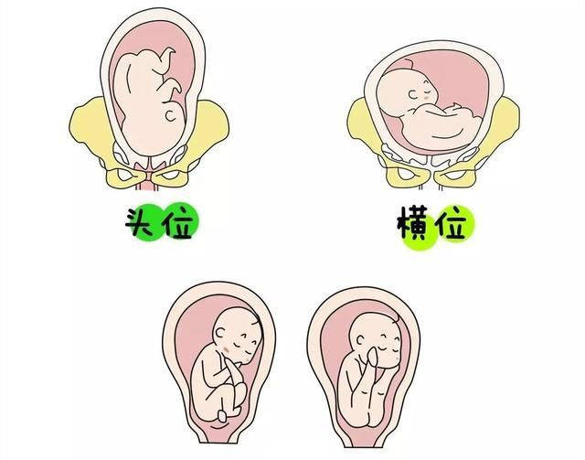胎儿入盆打嗝位置图解图片