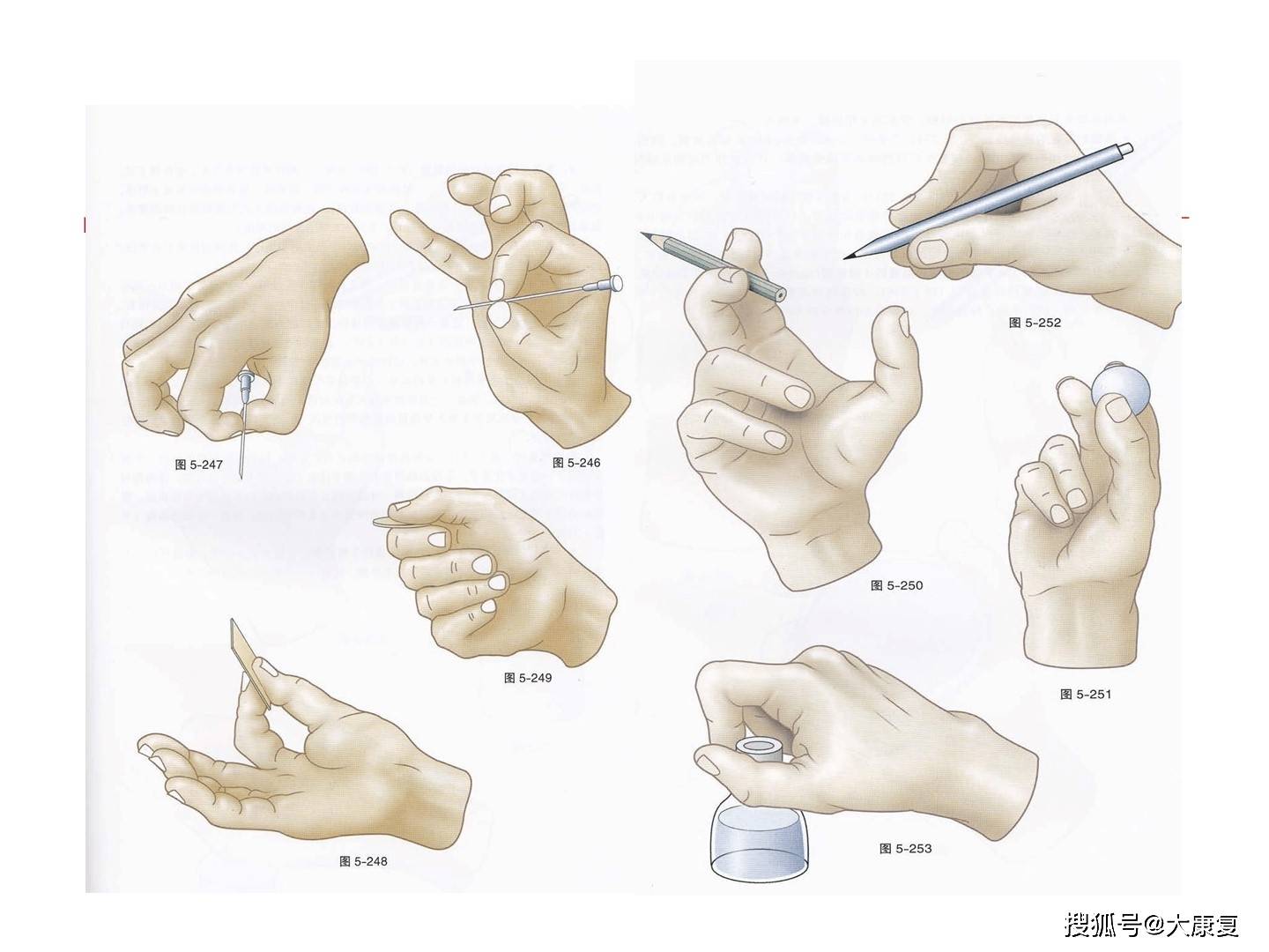 手功能障碍精准评估与治疗