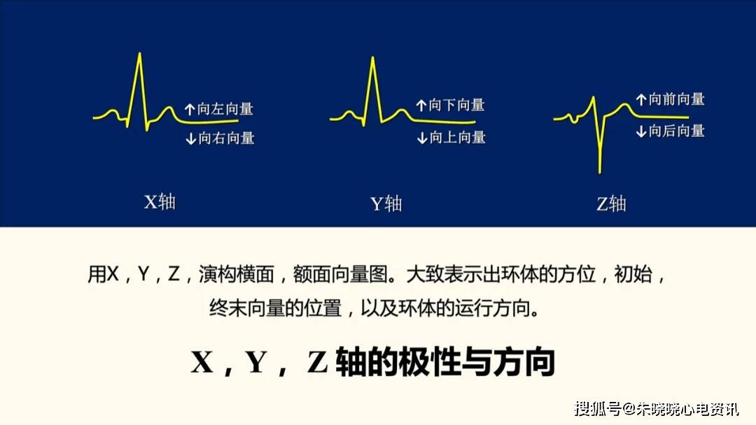 p环亦称p向量环,代表心房肌除极过程,其综合向量的方向(p电轴)指向左