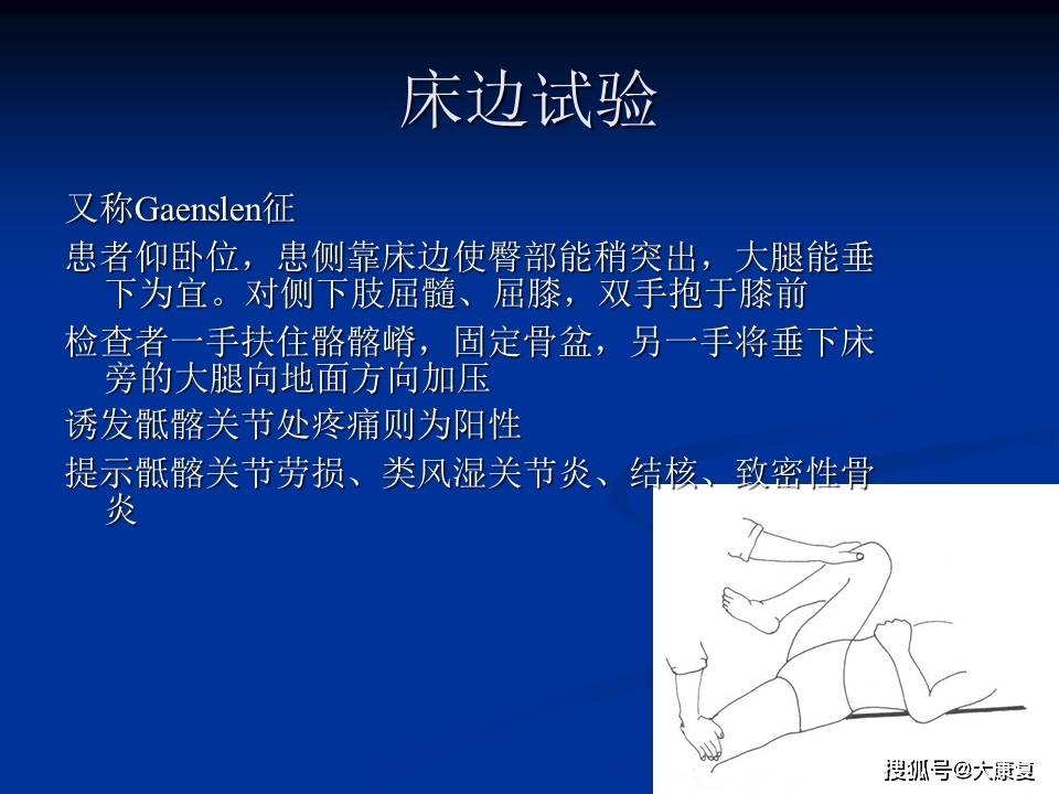 髋关节体格检查