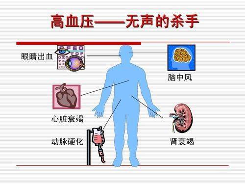 治疗高血压,这6个误区要留意