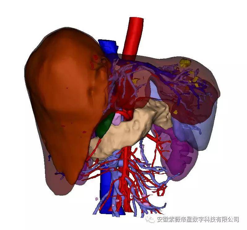 淋巴结关系图三维可视化技术清晰地显示肝脏肿瘤与肝脏管道的结构关系