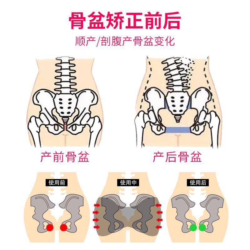 佰脉通·女子康复科 产后骨盆修复 案例选