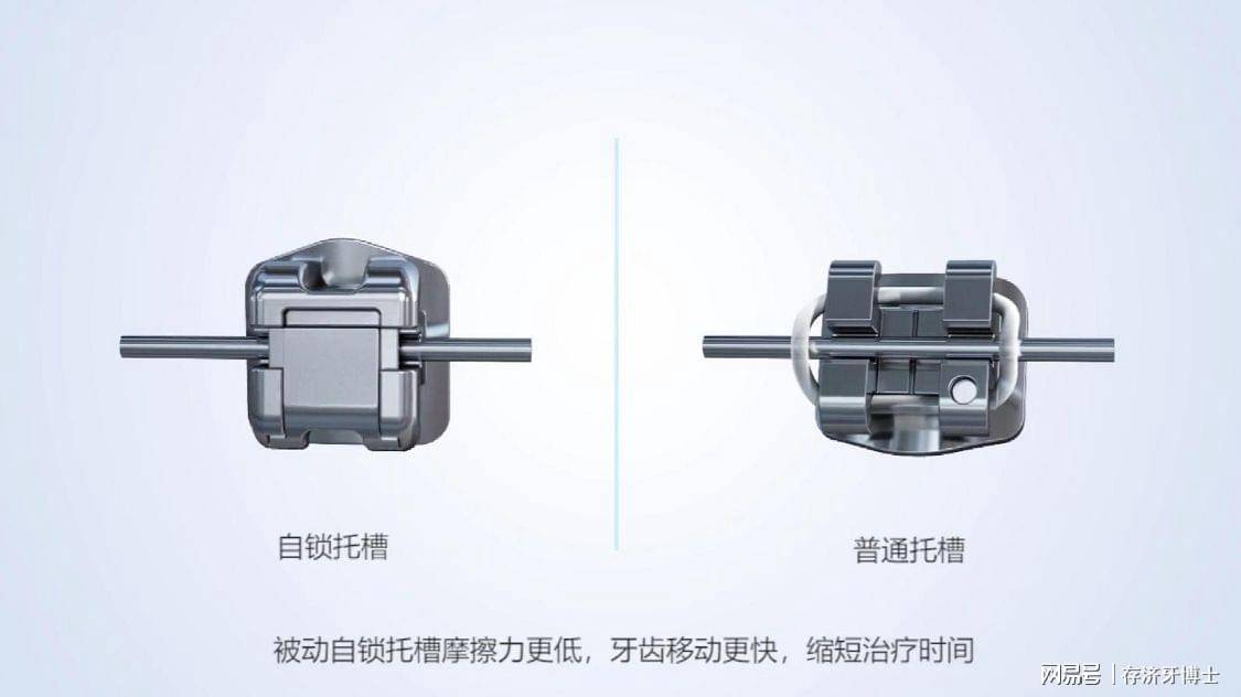 牙套自锁和非自锁的区别