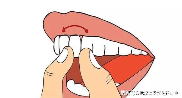 什么是生理性排斥 ad49cc4a13e240e0811e48653d11535c.jpeg
