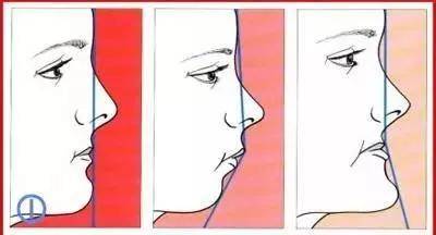 错合畸形和正畸详解 | 矫正—大同医学齿科医院_手机搜狐网