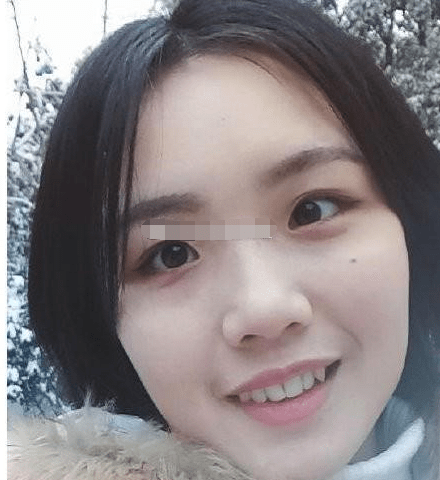 原创迁移宫有痣不合适异地发展易招小人干扰事业阻碍