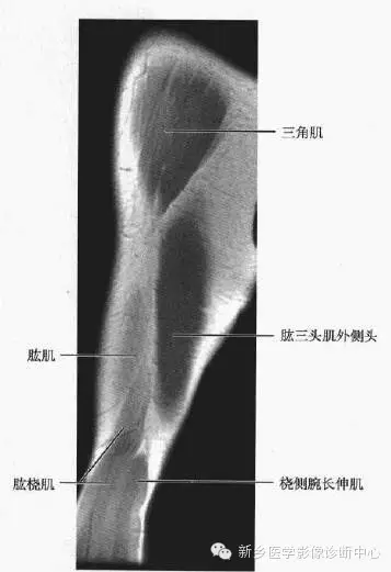 上臂磁共振解剖图谱