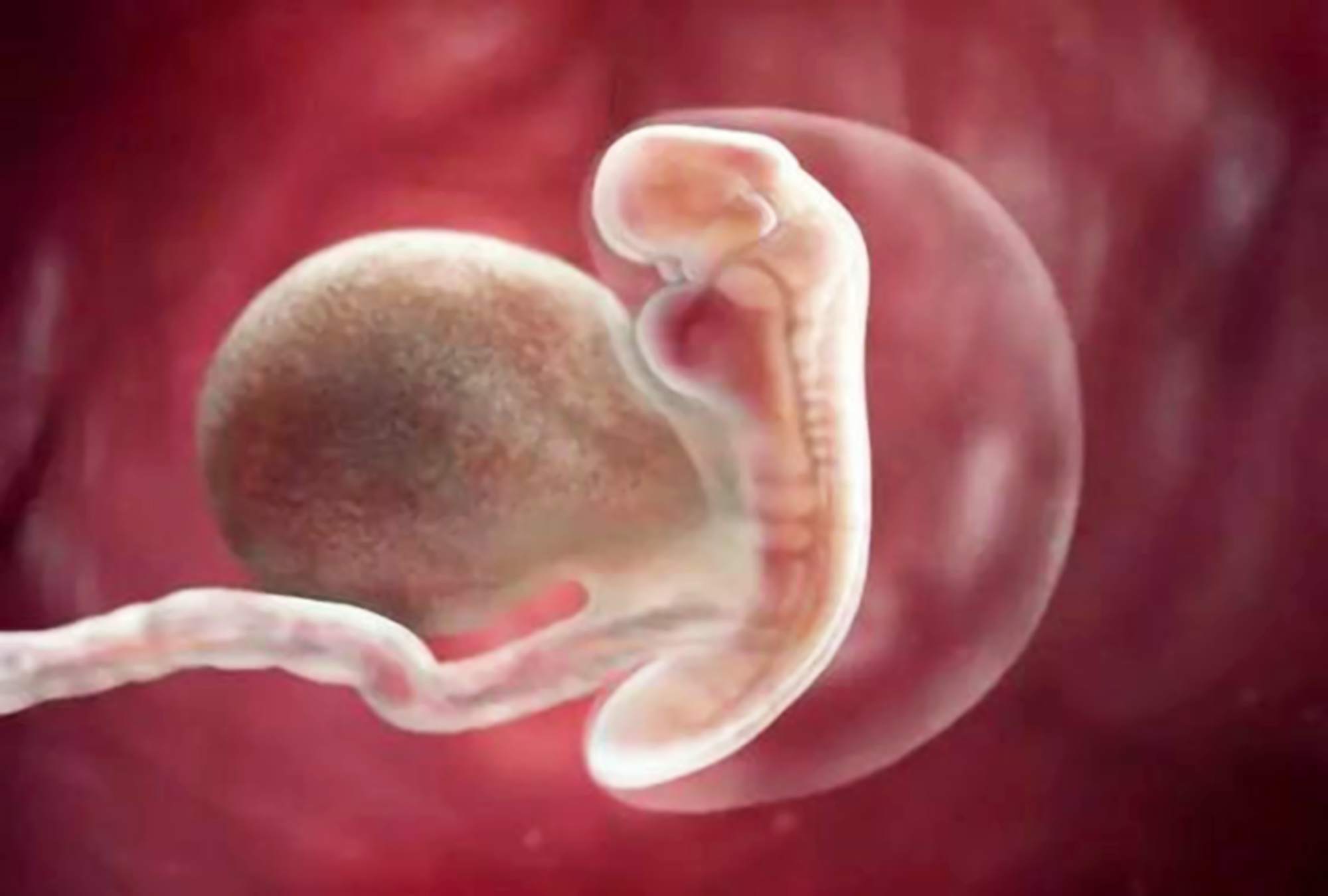 孕后期内脏被顶的图片图片