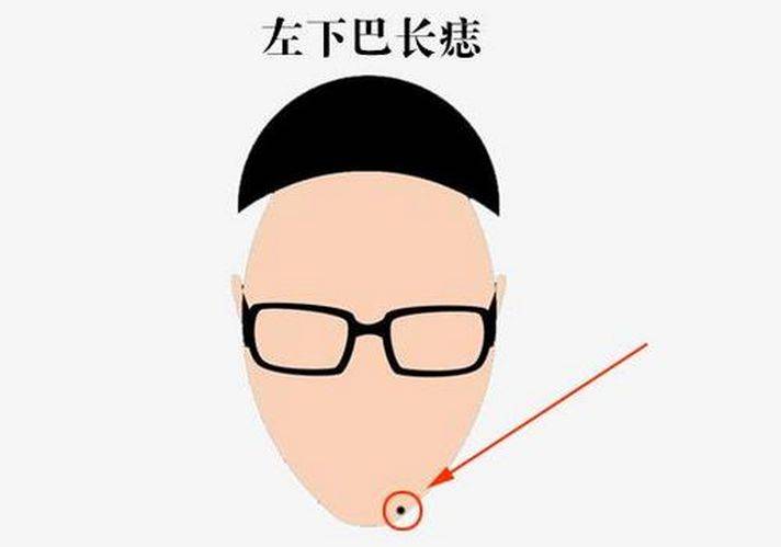 富贵痣,脸上四处长吉痣,发横财,遇贵人一生顺遂!