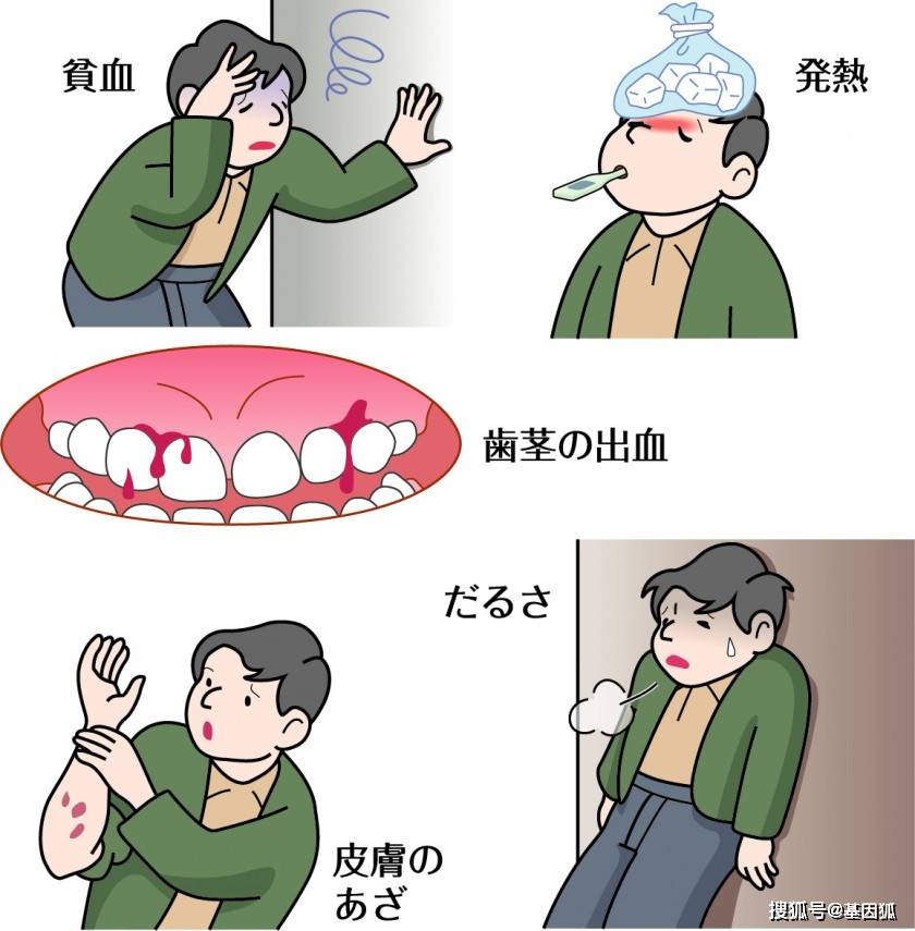 健康科普急性髓細胞性白血病aml常見症狀