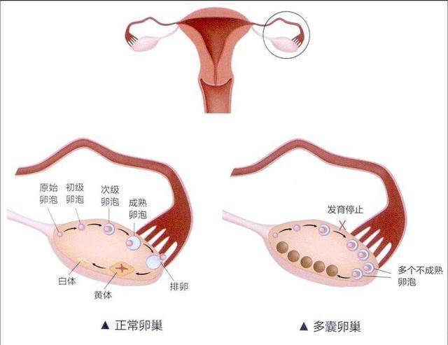 内分泌失调是什么原理_内分泌失调有什么症状(2)